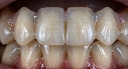 lip seal wear indicators